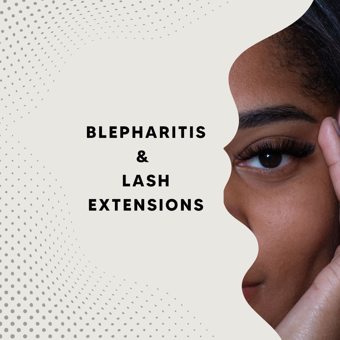 Understanding Blepharitis: A Guide for Lash Artists and Clients